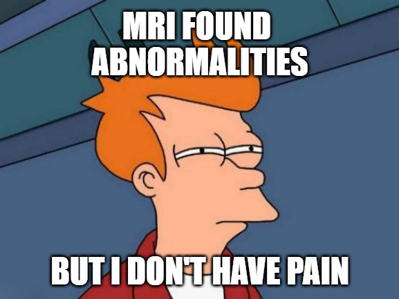 MRI found abnormalities... but I don't have pain.